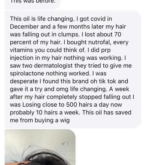 Custom Hair Growth Oil Transformation