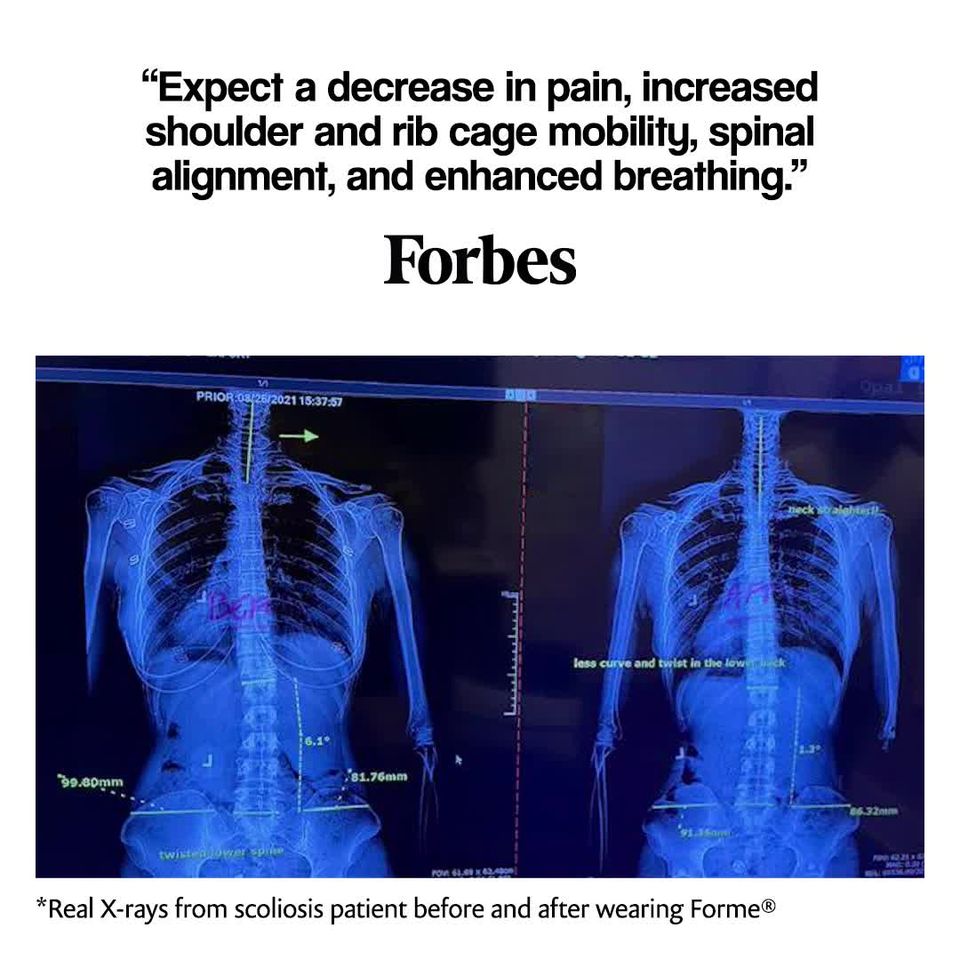 Posture Correcting Wearable Promo